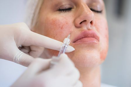 2.skin booster